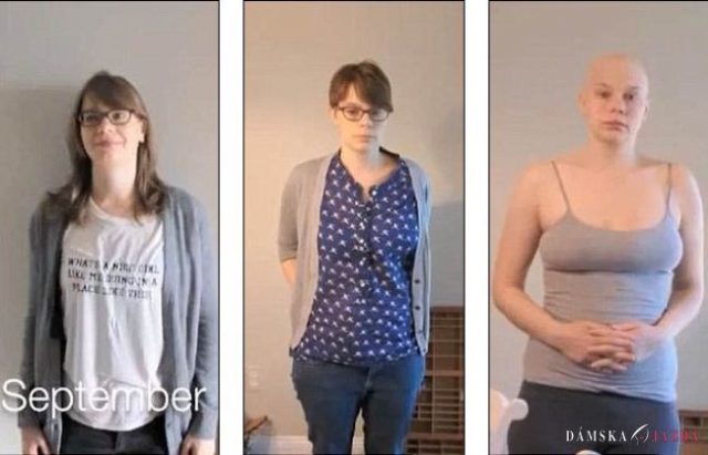 Žena zdokumentovala rok života s rakovinou v minútovom videu