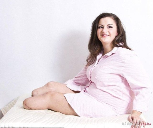 Priebojnej žene amputovali obe nohy, uspela ako modelka
