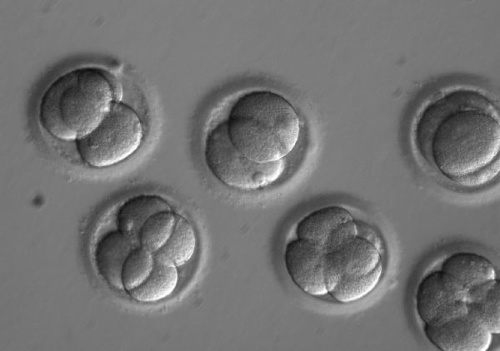 Embryo dna dedicne ochorenie.jpg